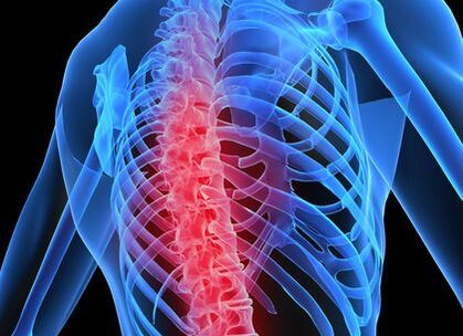 bizkarrezur torazikoko osteokondrosia